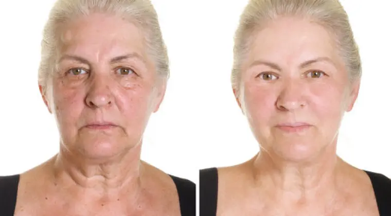 MASAŻ LIFTINGUJĄCY 